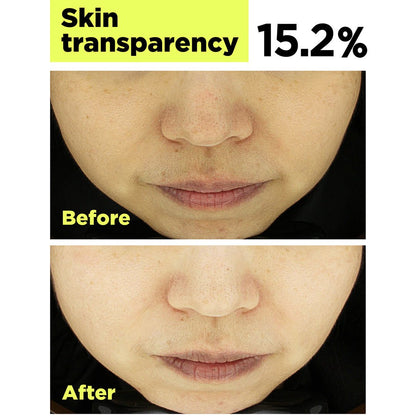 FINDIVE [FINDIVE] Bakuchiol Toning Ampoule (30ml) | Bakuchiol Ampoule In Mask (200ml) - Image 5