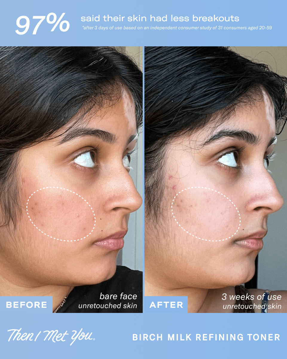 Then I Met You Birch Milk Refining Toner - Image 4 - Then I Met You