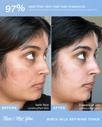 Then I Met You Birch Milk Refining Toner - Image 4